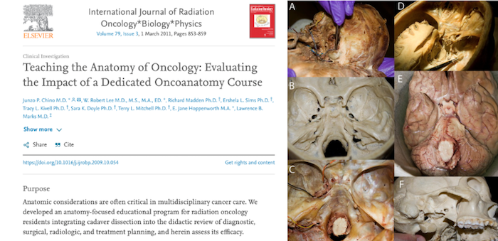 OncoAnatomy