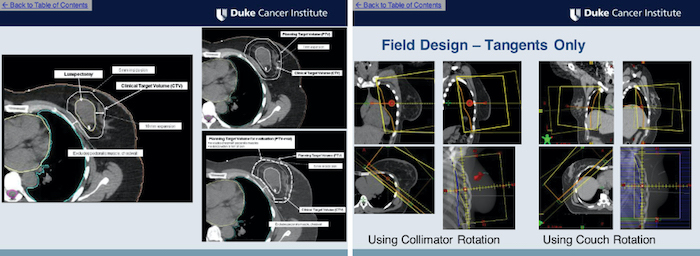 ROCC (Radiation Oncology Contouring Competency) Standardized Case Modules