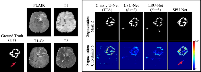MRI application in image-guided radiotherapy