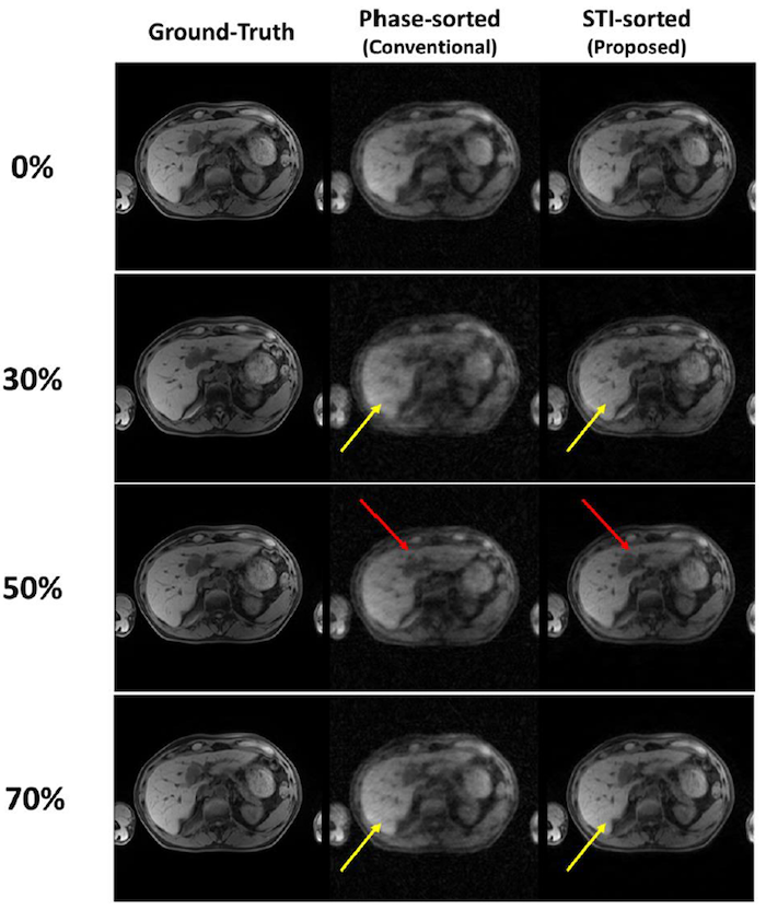 MRI application in image-guided radiotherapy