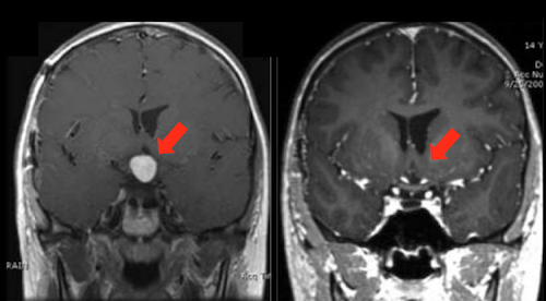 Clinical Approach: Radiotherapy and Therapeutic DNA Damage