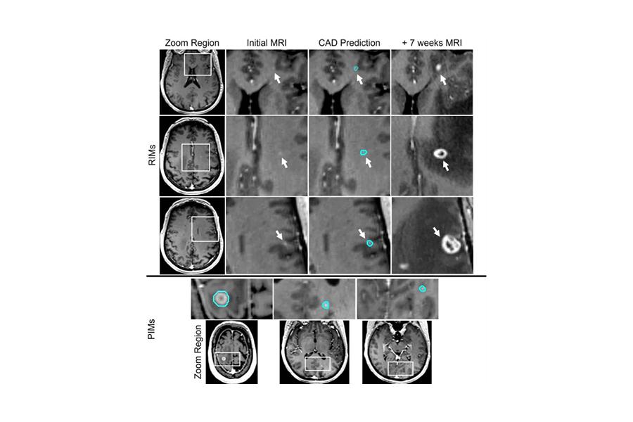 Deep-learning-based computer-aided detection (CAD) system