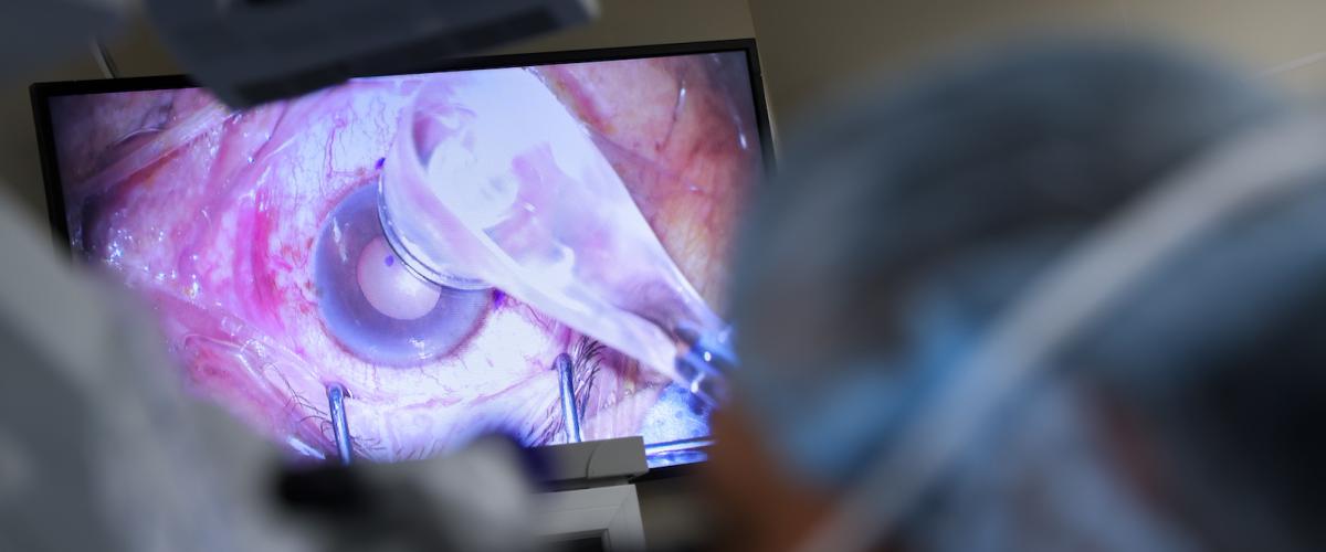 Close up of eye during brachytherapy procedure