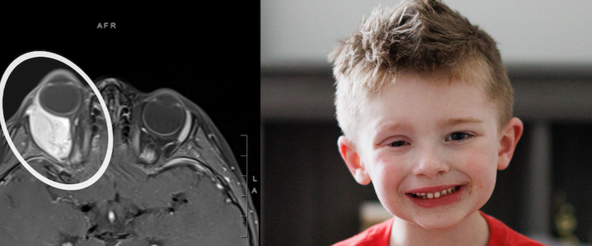 Colton Goodman, along with a scan of his eye