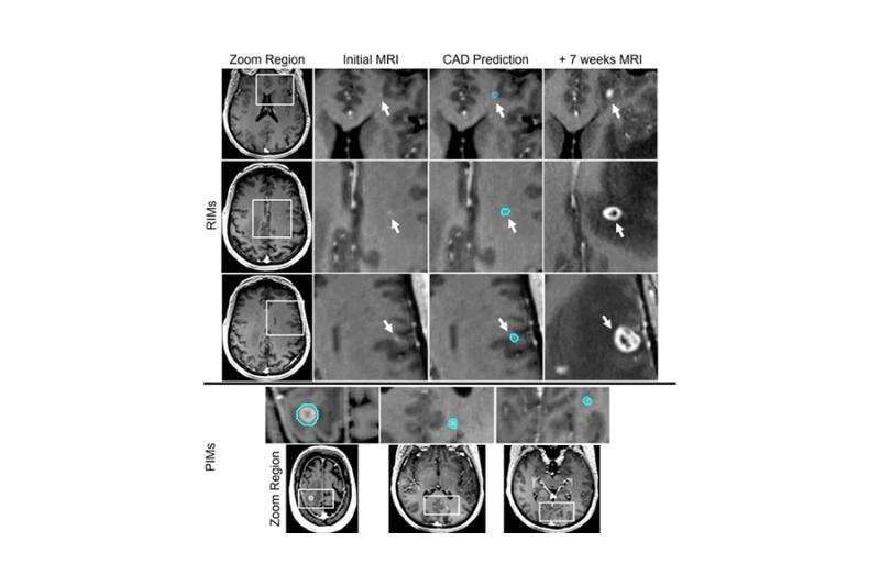 Deep-learning-based computer-aided detection (CAD) system