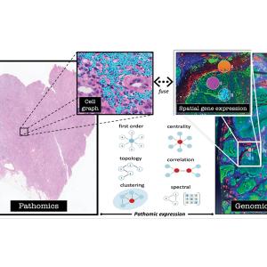 Fusion of mathematical immune cell topology with spatial gene expression